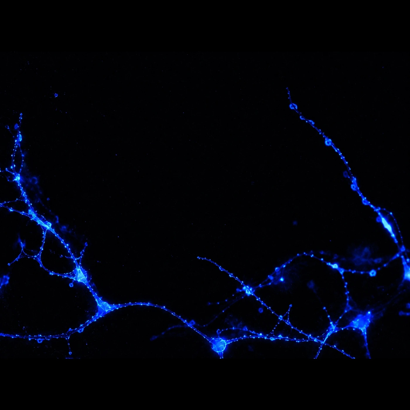 Blauw oplichtende neuronen op zwarte achtergrond als beeld voor biologie.